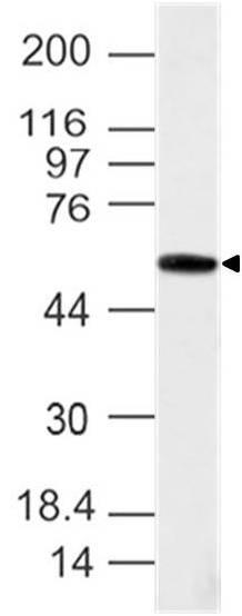 Polyclonal Antibody to Brachyury