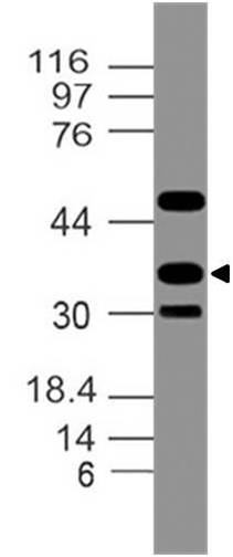 Polyclonal Antibody to CDX3