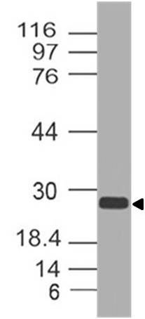 Polyclonal Antibody to APH1A