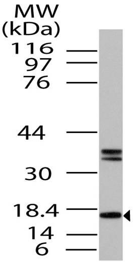 Polyclonal Antibody to FABP7