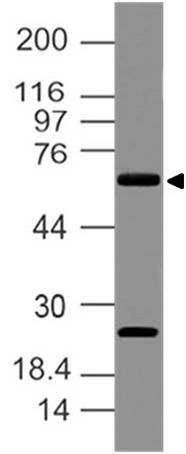 Polyclonal Antibody to Delta like 3