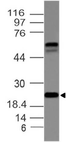 Polyclonal Antibody to FAM3C