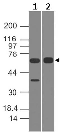 Polyclonal Antibody to ALAS1