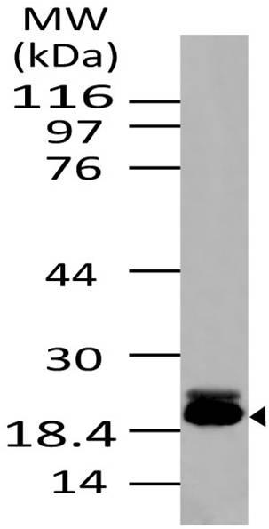 Polyclonal Antibody to Survivin