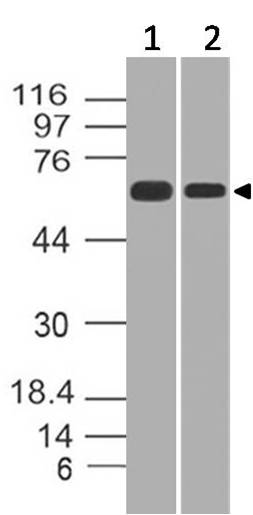 Polyclonal Antibody to hnRNPK