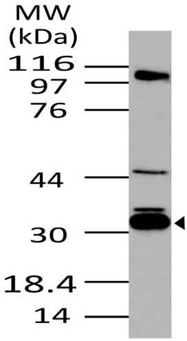 Polyclonal Antibody to 14-3-3 sigma