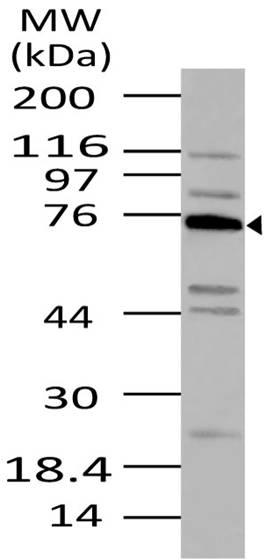 Polyclonal Antibody to Tnfaip2