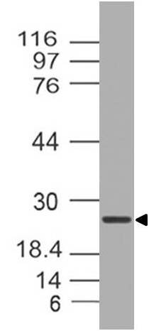 Polyclonal Antibody to TRAM