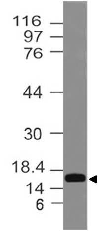 Polyclonal Antibody to  LC3 A