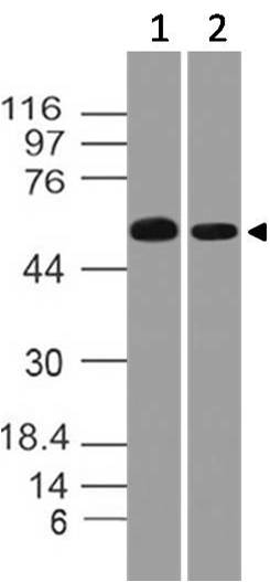 Polyclonal Antibody to Catalase