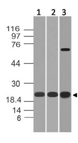 Polyclonal antibody to Cbx5