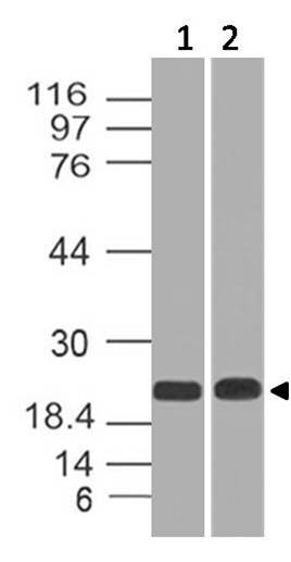 Polyclonal Antibody to Cbx5