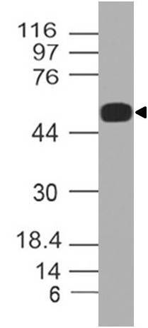 Polyclonal Antibody to SPZ1/TSP1