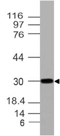 Polyclonal Antibody to HOXA9