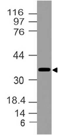 Polyclonal Antibody to NKX2-5