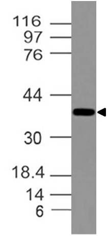 Polyclonal Antibody to DLX3/distal-less homeobox 3