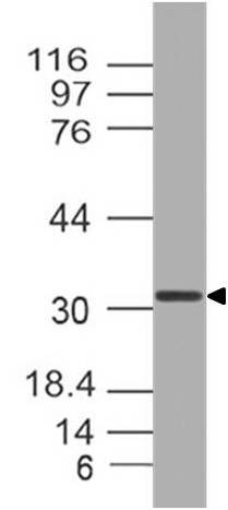 Polyclonal Antibody to Otx2