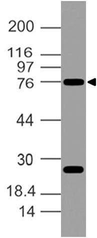 Polyclonal Antibody to OCT1