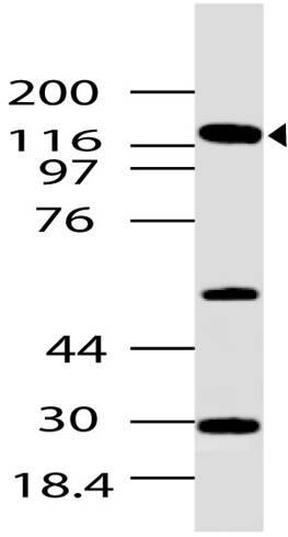 Polyclonal Antibody to GLI1