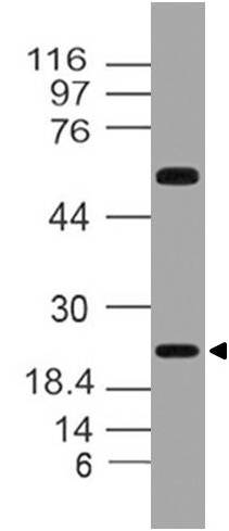 Polyclonal Antibody to Fibroblast growth factor 20