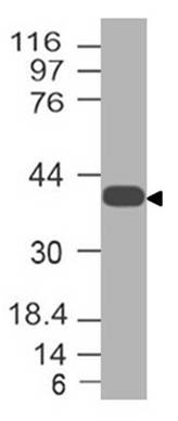 Polyclonal Antibody to KLF8