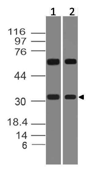 Polyclonal Antibody to HoxD8