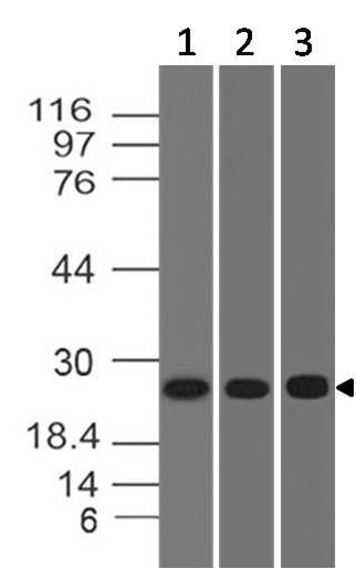 Polyclonal Antibody to ERAS