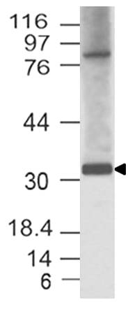 Polyclonal Antibody to HEY1