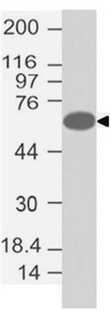 Polyclonal Antibody to FOXC1