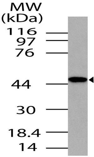 Polyclonal Antibody to TRBP