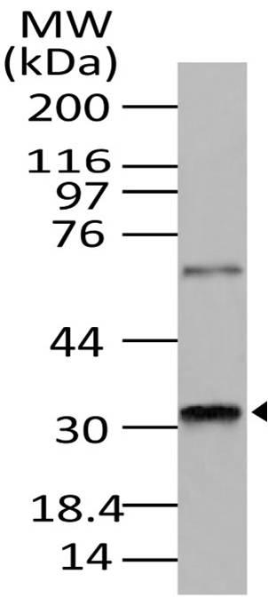 Polyclonal Antibody to RAX