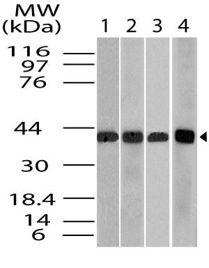 Polyclonal Antibody to Beta actin