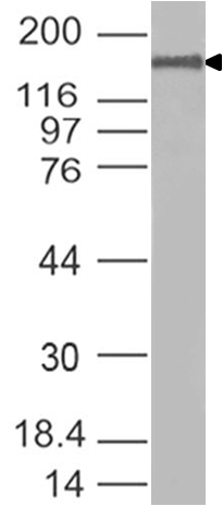 Coronavirus (COVID-19) Spike Protein Antibody