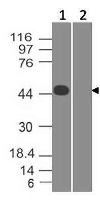 Polyclonal Antibody to SARS-CoV-2 nucleocapsid Protein