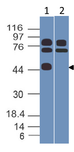 SARS-CoV2 N-Term Nucleocapsid Antibody