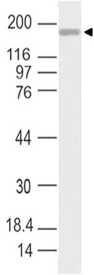 SARS-CoV-2 Spike S1 Antibody