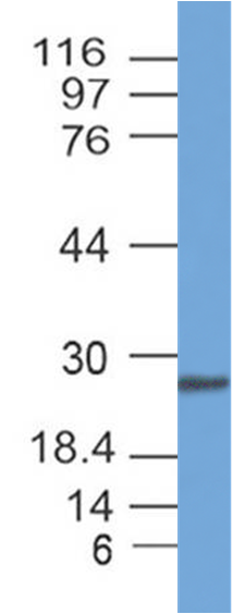 SARS-CoV2 Spike RBD Antibody