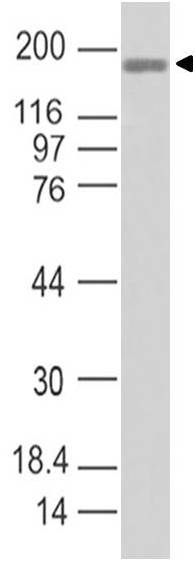 COVID-19/SARS-CoV-2 Spike S1 Antibody