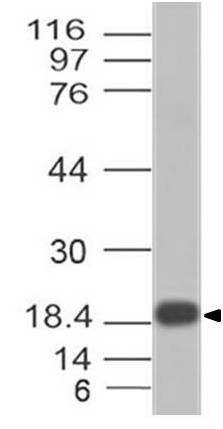 Anti Monkey Pox L1R Polyclonal Antibody