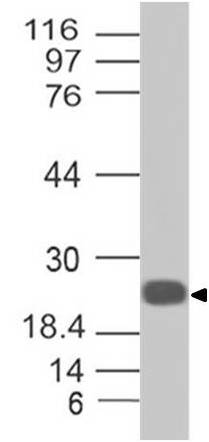 Anti CRP Polyclonal Antibody