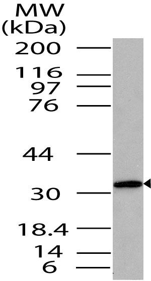 Polyclonal Antibody to ST2