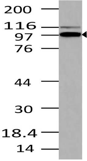 Polyclonal Antibody to TRIL