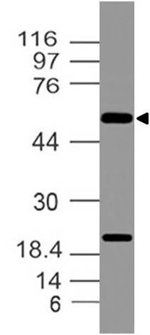 Polyclonal Antibody to IMPDHII