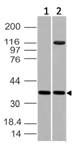 Polyclonal Antibody to Embigin, EMB