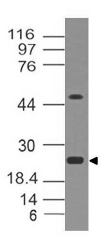 Polyclonal Antibody to EBI3, mouse