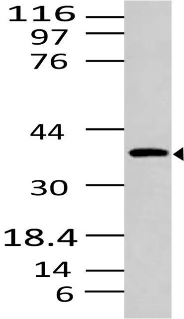 Polyclonal Antibody to S1PR1