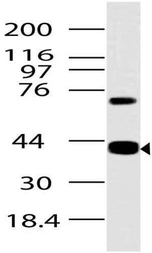 Polyclonal Antibody to RAGE