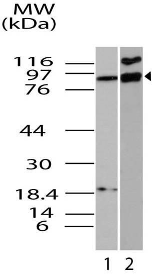 Polyclonal Antibody to ifi-204 (mouse)