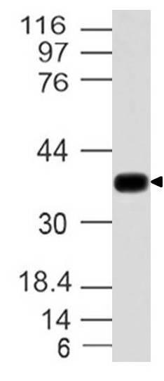 Polyclonal Antibody to Nucleophosmin