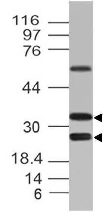 Polyclonal Antibody to CLEC12A/MICL